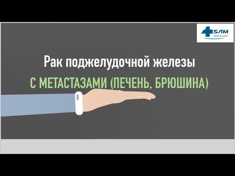 Видео: Интервью пациента с раком поджелудочной железы, 4 стадия (2)