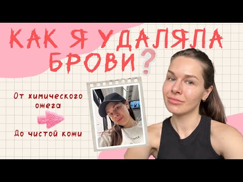 Видео: Убрать перманент бровей: лазер или ремувер? Все за и против