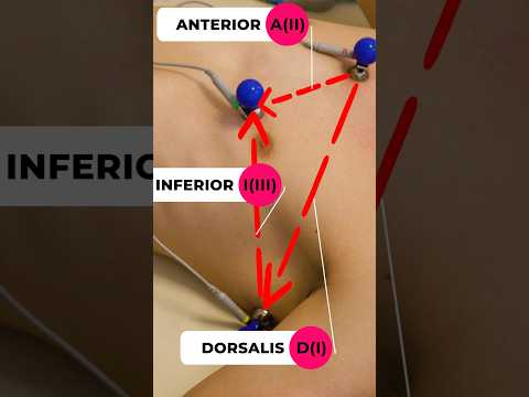Видео: #экг #отведения #просмп #кардиолог #скораяпомощь