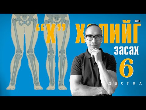 Видео: Inward Knee Exercises | "Х" хөлийг засах дасгалууд