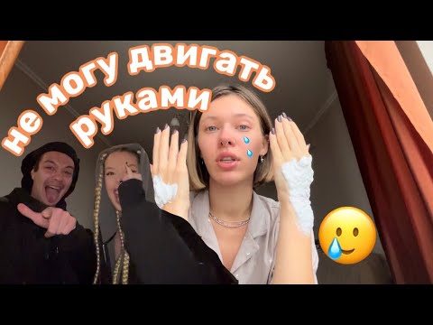 Видео: СОЖГЛА РУКИ, ЖИВУ ДАЛЬШЕ | VLOG