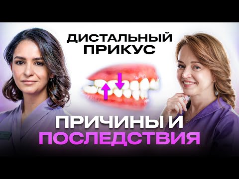 Видео: ЧТО БУДЕТ, ЕСЛИ НЕ ИСПРАВИТЬ ДИСТАЛЬНЫЙ ПРИКУС? РАССКАЗЫВАЕТ ОРТОДОНТ - ЛУСИНЕ ВЕКИЛЯН