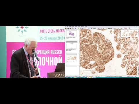 Видео: Диагностические сложности: редкие опухоли РМЖ. Клинический случай 3