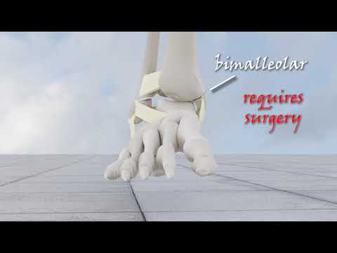 Видео: Классификация переломов лодыжки