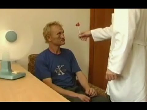 Видео: Белая горячка - симптомы, причины возникновения и лечение