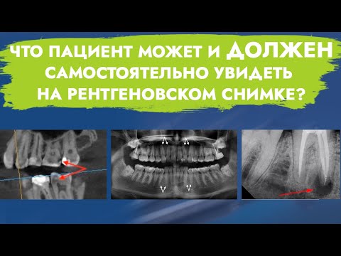 Видео: Рентгеновское исследование. Практический минимум для пациентов.