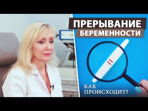 Видео: Аборт - медикаментозное или хирургическое прерывание беременности
