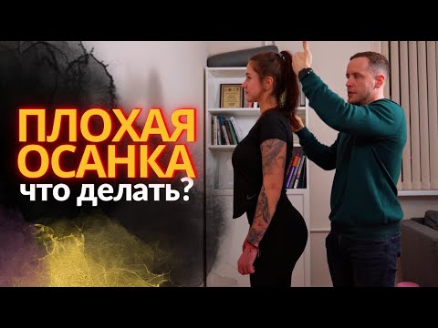 Видео: Упражнения для ОСАНКИ | Как исправить сколиоз | Причины плохой осанки