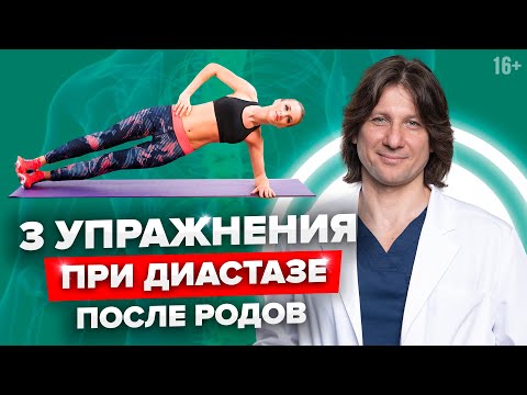 Видео: ДИАСТАЗ после родов. Как определить диастаз. 3 Эффективных упражнения при ДИАСТАЗЕ //16+