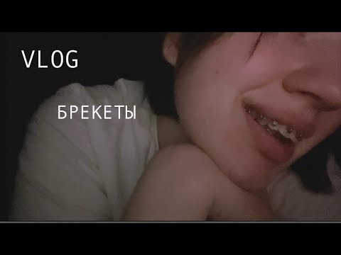 Видео: Брекеты. Vlog