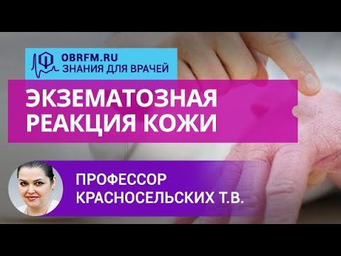 Видео: Профессор Красносельских Т.В.: Экзематозная реакция кожи