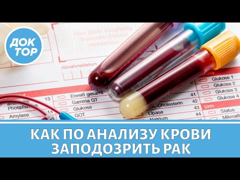 Видео: Врач-онколог объяснил, как по анализу крови заподозрить рак