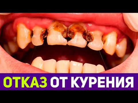 Видео: Последствия отказа от курения