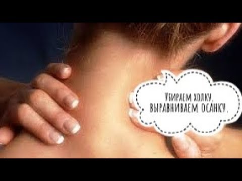 Видео: Как убрать холку на шее, прострел между лопатками и выровнять осанку.