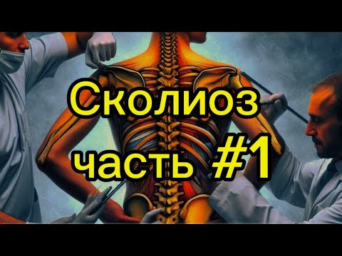 Видео: коррекция сколиоза стоя по методу Фельденкрайза.