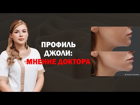 Видео: ПРОФИЛЬ ДЖОЛИ 💃🏻КОМУ ЗАПРЕЩЕНЫ УГЛЫ ДЖОЛИ?