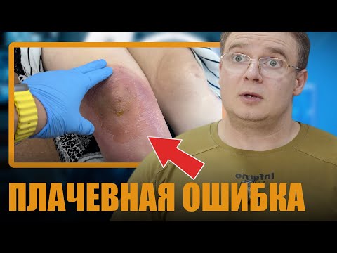 Видео: ГНОЙНЫЙ БУРСИТ КОЛЕНА | Ошибки в тактике лечения