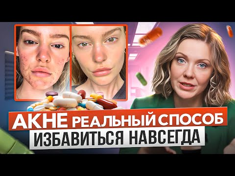 Видео: Эффективные средства для лечения Акне. Угревая болезнь - симптомы, причины, лечение акне.