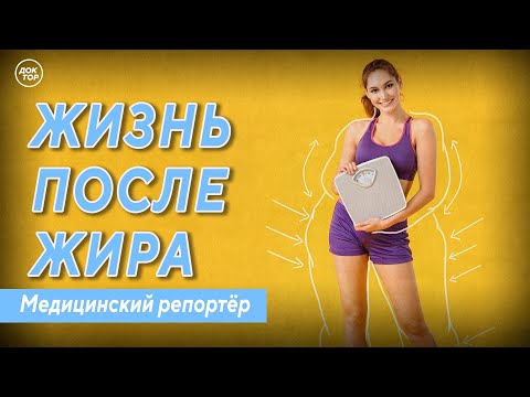 Видео: Он весил 206 кг, а она – 140. Жизнь после жира. Медицинский репортёр