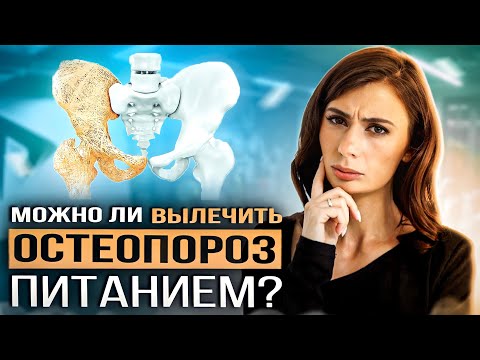Видео: ЧТО ЕСТЬ при ОСТЕОПОРОЗЕ? Как вылечить остеопороз питанием и возможно ли ЭТО?