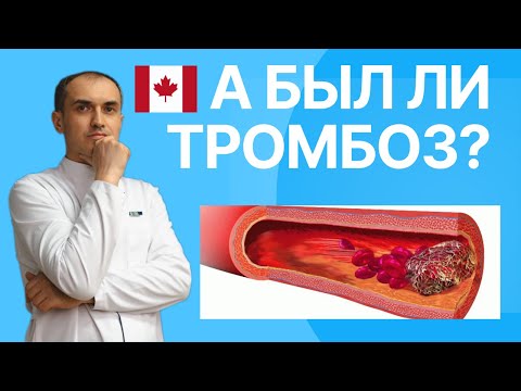 Видео: Пить разжижающие таблетки всю жизнь! Зачем? Флеболог Москва.