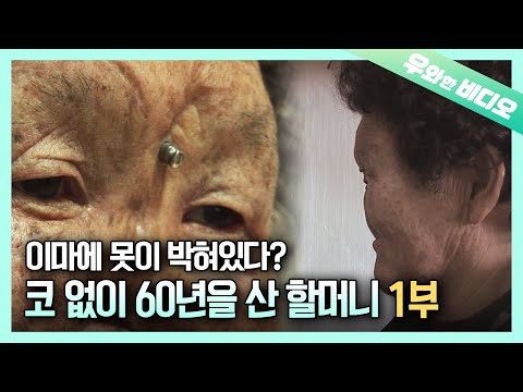 Видео: Причина, по которой у нее во лбу гвоздь