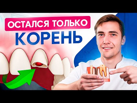 Видео: Как восстановить зуб, если от него остался только корень?