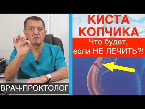 Видео: КИСТА КОПЧИКА - ЧТО БУДЕТ если НЕ ЛЕЧИТЬ?