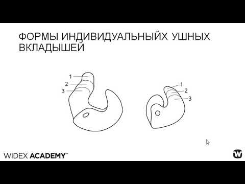 Видео: Отопластика. Акустические конфигурации.