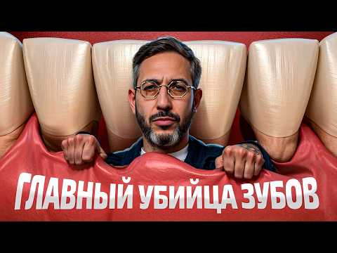 Видео: Все о рецессии десны в 1 видео простыми словами. Вопросов НЕ останется!