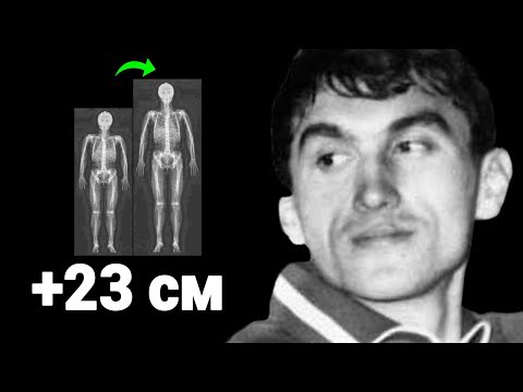 Видео: Обыграл ГЕНЕТИКУ - Как он увеличил рост на 23 см