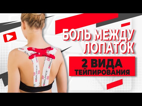 Видео: ▶️ БОЛЬ МЕЖДУ ЛОПАТКАМИ / ДВА ВИДА ТЕЙПИРОВАНИЯ | Валентин Гайт | Учебный центр BBALANCE