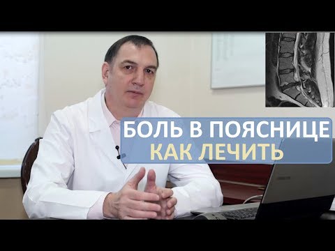 Видео: Острая боль в пояснице: как лечить. Грыжа диска, люмбаго, ишиас, радикулит.