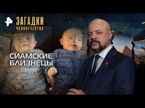 Видео: Сиамские близнецы — Загадки человечества с Олегом Шишкиным