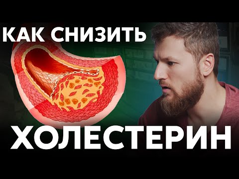 Видео: Как снизить ХОЛЕСТЕРИН, избавляемся от атеросклероза