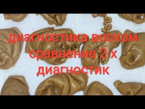 Видео: 🔁сравнение❗восковых 💯2-х диагностик с магическим и без магического воздействия