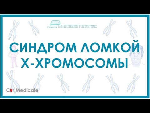 Видео: Синдром ломкой Х-хромосомы ака с. Мартина-Белл - механизм развития, причины, клинические проявления