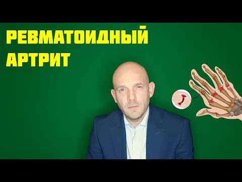 Видео: РЕВМАТОИДНЫЙ АРТРИТ