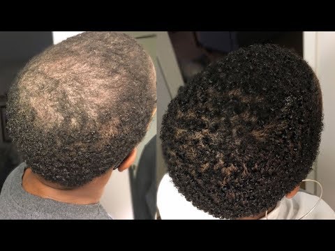 Видео: Моя 100% натуральная сыворотка для роста волос | Обзор за 2 месяца — #GrowWithMe | Ниа Хоуп