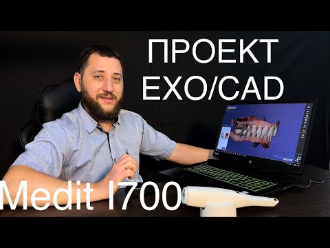 Видео: Создание проекта EXO/CAD после внутриротового сканирования на Medit I700. Зубной техник. Стоматолог.