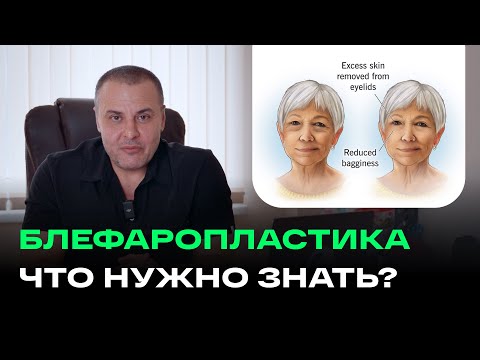 Видео: БЛЕФАРОПЛАСТИКА СТОИТ ЛИ ДЕЛАТЬ? НЕ РАНО ЛИ?