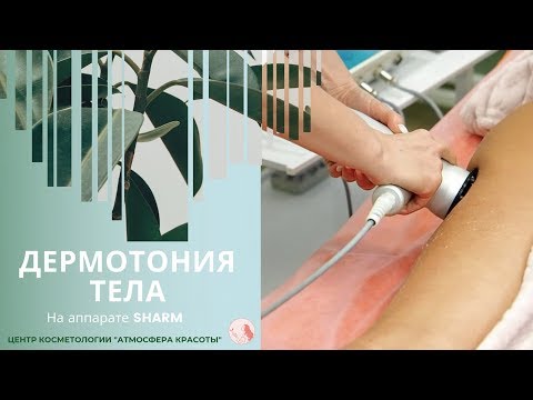 Видео: Дермотония тела