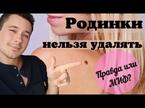 Видео: Опасные родинки! Меланома, рак после удаления родинки?