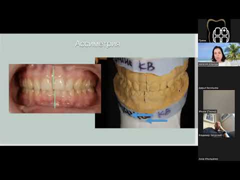 Видео: Артикулятор PROMO. Вебинар Наталии Апачиди