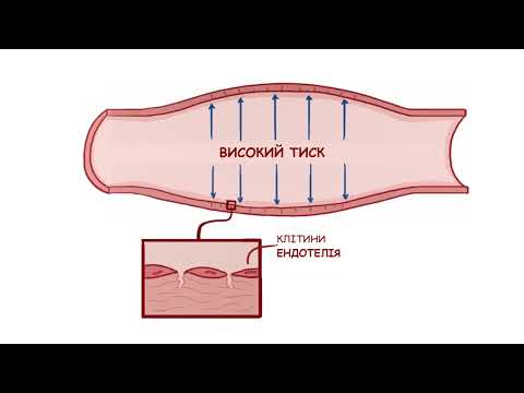 Видео: АРТЕРІАЛЬНА ГІПЕРТЕНЗІЯ