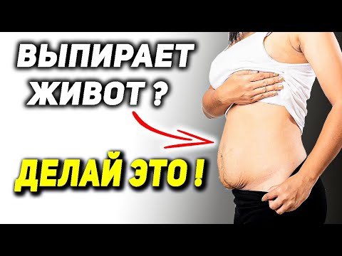 Видео: Выпирает живот, гиперлордоз, болит поясница, слабые ягодицы? ДЕЛАЙ ЭТО!