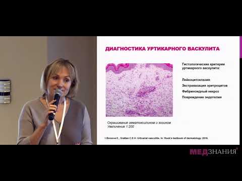 Видео: 06. Дифференциальная диагностика хронической крапивницы. Е.Ю.Борзова