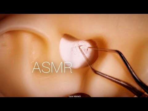 Видео: ASMR Очень сильная чистка ушей с использованием острого инструмента на очень твердой ушной сере