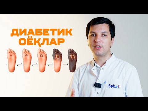 Видео: ҚАНДЛИ ДИАБЕТДА ОЁҚЛАРНИ ҚАНДАЙ САҚЛАБ ҚОЛИШ МУМКИН? БУ ТАВСИЯЛАР ОЁҚЛАРНИ КЕСИЛИШДАН АСРАЙДИ!