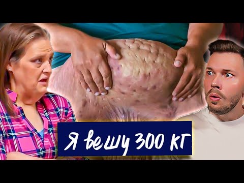 Видео: Уберите это с меня ► Я вешу 300 кг Что было дальше Сезон 2/4 ► Бетти Джо и Сьюзан
